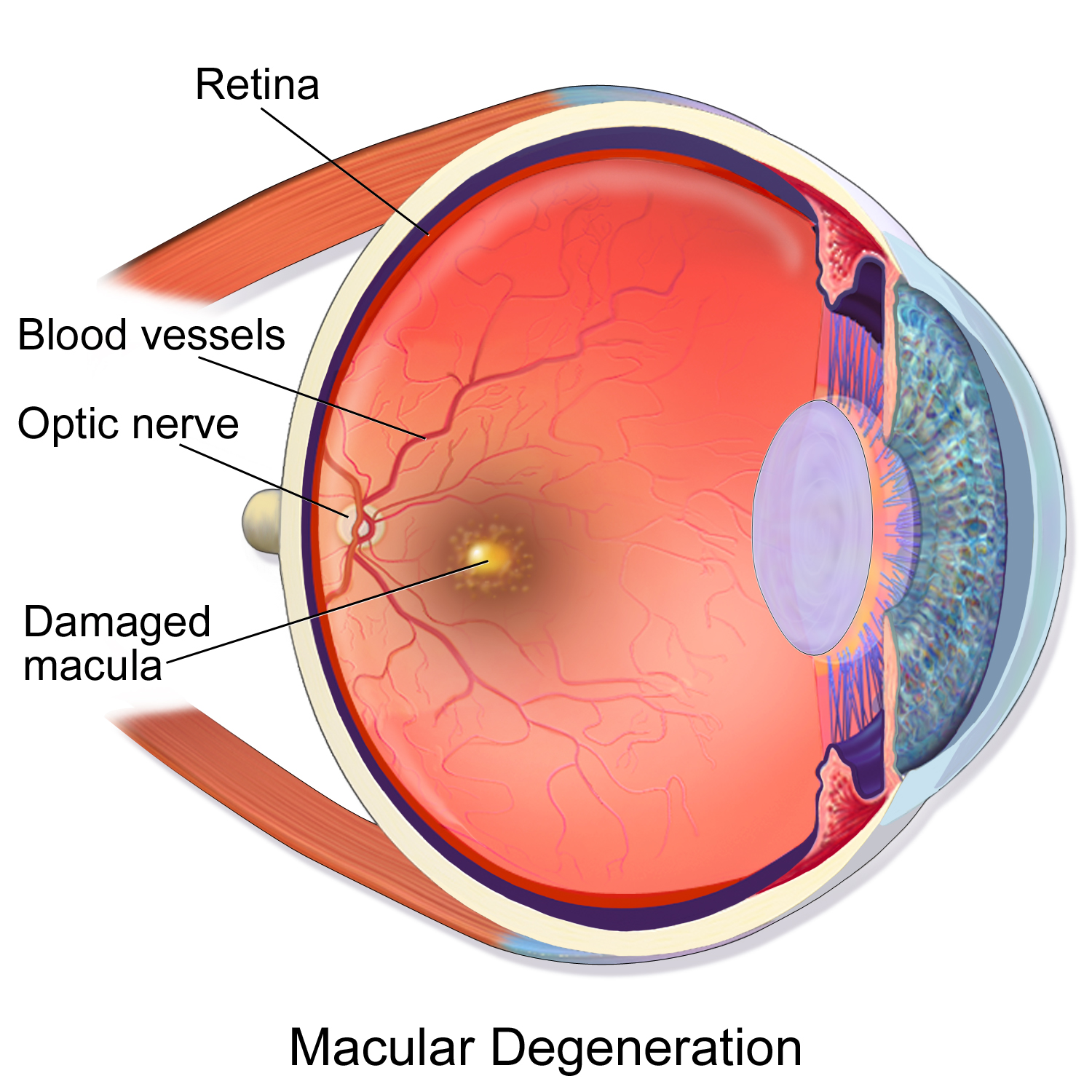 Macular Degeneration in Victorville, CA High Desert Institute of
